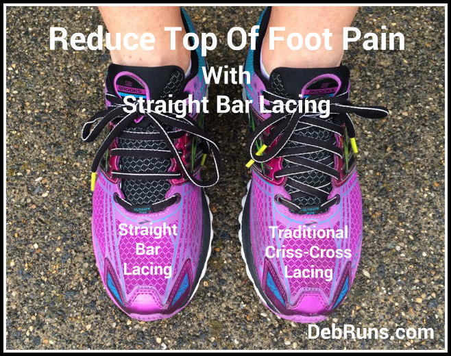 Straight Bar Lacing – A Simple Lacing Change Can Rid Foot Pain